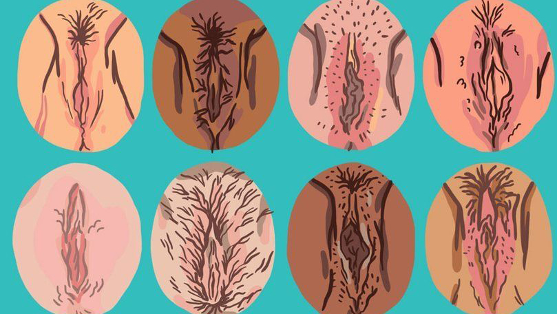 O que você precisa saber sobre vulvas diferentes tipos e cores